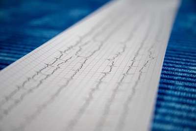Exames laboratoriais medicina do trabalho